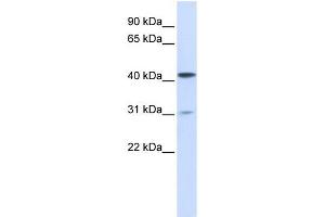 TMPRSS11D antibody used at 1 ug/ml to detect target protein. (TMPRSS11D anticorps  (Middle Region))