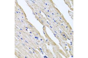 Immunohistochemistry of paraffin-embedded rat heart using RCN2 antibody at dilution of 1:100 (x40 lens). (RCN2 anticorps)