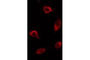 ABIN6274467 staining HT29 cells by IF/ICC. (PMEPA1 anticorps  (Internal Region))