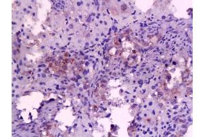 Formalin-fixed and paraffin embedded rat liver tissue labeled with Anti-IL-6(mo, rat) Polyclonal Antibody, Unconjugated (ABIN728083) at 1:200, followed by conjugation to the secondary antibody and DAB staining