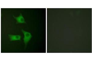 Immunofluorescence analysis of HeLa cells, using p15 INK antibody (ABIN5976476).