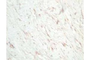 Image no. 1 for anti-Secreted Frizzled-Related Protein 1 (SFRP1) antibody (ABIN401251) (SFRP1 anticorps)