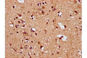 IHC image of ABIN7169865 diluted at 1:200 and staining in paraffin-embedded human brain tissue performed on a Leica BondTM system. (SNRPE anticorps  (AA 1-92))