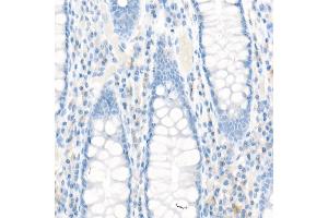 Immunohistochemistry of paraffin-embedded Human colon using MRP1/ antibody (ABIN7265736) at dilution of 1:100 (40x lens). (ABCC1 anticorps)