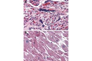 Immunohistochemical staining of formalin-fixed, paraffin-embedded human placenta (A) and human heart (B) tissue after heat-induced antigen retrieval. (ADCYAP1R1 anticorps  (Extracellular Domain))