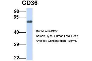 Host:  Rabbit  Target Name:  CD36  Sample Type:  Human Fetal Heart  Antibody Dilution:  1. (CD36 anticorps  (N-Term))