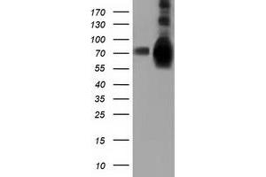 HEK293T cells were transfected with the pCMV6-ENTRY control (Left lane) or pCMV6-ENTRY HSPA6 (Right lane) cDNA for 48 hrs and lysed.