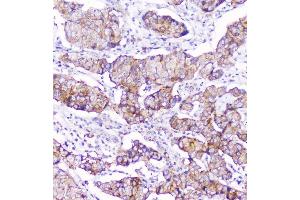 IHC analysis of CD2AP using anti-CD2AP antibody (ABIN6719544). (CD2AP anticorps  (AA 253-337))