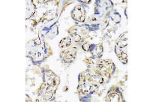 Immunohistochemistry of paraffin-embedded human placenta using F Rabbit pAb (ABIN6127814, ABIN6140422, ABIN6140423 and ABIN6221993) at dilution of 1:200 (40x lens).