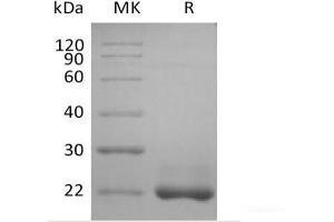 Western Blotting (WB) image for Tumor Necrosis Factor (Ligand) Superfamily, Member 13b (TNFSF13B) protein (His tag) (ABIN7319779)