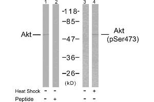 Western blot analysis of extracts from HeLa cells treated or untreated with heat shock using Akt(Ab-473) Antibody and Akt(Phospho-Ser473) Antibody. (AKT1 anticorps  (pSer473))
