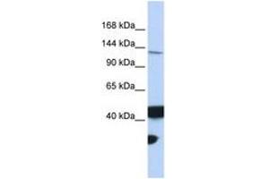 Image no. 1 for anti-MutL Homolog 3 (MLH3) (AA 1188-1237) antibody (ABIN6743100) (MLH3 anticorps  (AA 1188-1237))