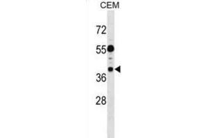 Western Blotting (WB) image for anti-Tumor Suppressing Subtransferable Candidate 1 (TSSC1) antibody (ABIN2999073) (TSSC1 anticorps)