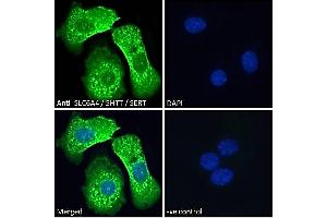 ABIN185394 Immunofluorescence analysis of paraformaldehyde fixed HepG2 cells, permeabilized with 0.
