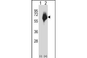 Western blot analysis of P2 (arrow) using rabbit polyclonal P2 Antibody (Center) (ABIN657616 and ABIN2846612). (MMP2 anticorps  (AA 303-331))
