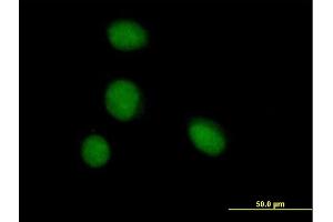Immunofluorescence of purified MaxPab antibody to ZBTB6 on HeLa cell. (ZBTB6 anticorps  (AA 1-424))