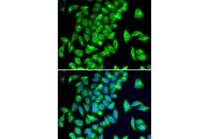 Immunofluorescence analysis of  cells using TPH2 antibody (ABIN6133469, ABIN6149436, ABIN6149437 and ABIN6222965). (Tryptophan Hydroxylase 2 anticorps  (AA 1-170))