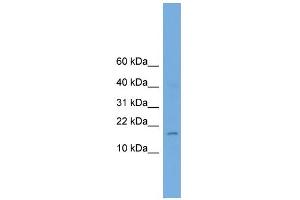 WB Suggested Anti-A830053O21Rik Antibody Titration:  0.
