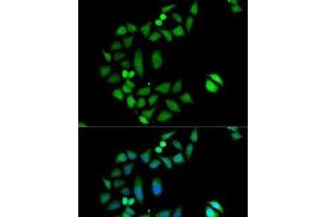 Immunofluorescence analysis of MCF7 cells using CLIC1 Polyclonal Antibody