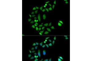 Immunofluorescence analysis of MCF7 cells using CLIC1 Polyclonal Antibody (CLIC1 anticorps)