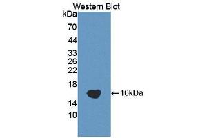 Western blot analysis of the recombinant protein.