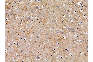 ABIN6258928 and ABIN6276017 at 1/100 staining mouse brain tissue by IHC-P. (GPR156 anticorps  (Internal Region))