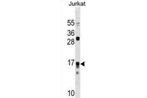 Western Blotting (WB) image for anti-Interleukin 17 Receptor C (IL17RC) antibody (ABIN3000332) (IL17RC anticorps)