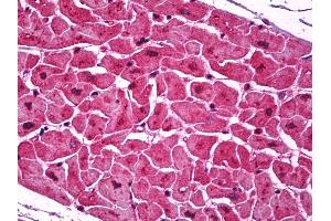 Anti-Podoplanin antibody IHC of human heart. (Podoplanin anticorps  (AA 1-206))
