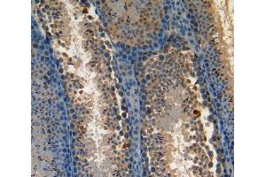 Used in DAB staining on fromalin fixed paraffin-embedded Kidney tissue (AATK anticorps  (AA 137-386))