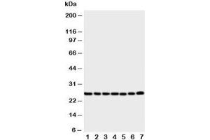 Western blot testing of SIP antibody and Lane 1:  rat liver ;  2: (r) brain;  3: (r) spleen;  4: human SMMC-7721;  5: (h) COLO320;  6: (h) SW620;  7: (h) 293T cell lysate (CACYBP anticorps  (Middle Region))