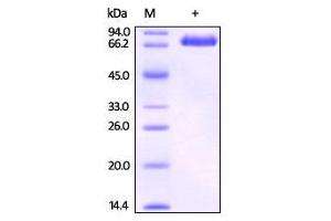 Biotinylated Human EphB4 on SDS-PAGE under reducing (R) condition. (EPH Receptor B4 Protein (EPHB4) (AA 16-539) (His tag,Biotin))