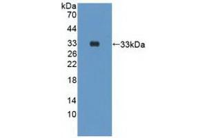 Detection of Recombinant PIK3Cd, Human using Polyclonal Antibody to Phosphoinositide-3-Kinase Catalytic Delta Polypeptide (PIK3Cd) (PIK3CD anticorps  (AA 774-1044))