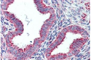 Human Uterus (formalin-fixed, paraffin-embedded) stained with HSPD1 antibody ABIN462365 followed by biotinylated anti-goat IgG secondary antibody ABIN481715, alkaline phosphatase-streptavidin and chromogen.