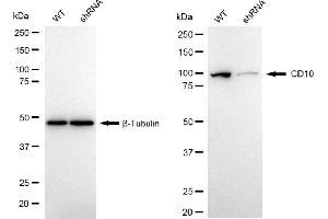 Western blotting analysis using CD10 antibody (ABIN7799365).
