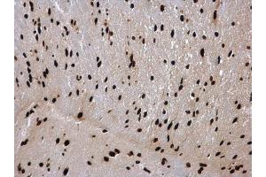 IHC-P Image hnRNP C1/C2 antibody detects hnRNP C1/C2 protein at nucleus in mouse brain by immunohistochemical analysis.
