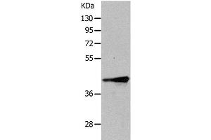 Western Blot analysis of Human fetal muscle tissue using TRIM63 Polyclonal Antibody at dilution of 1:1050 (TRIM63 anticorps)