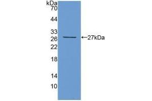 Detection of Recombinant TIGIT, Mouse using Polyclonal Antibody to T-Cell Immunoreceptor With Ig And ITIM Domains Protein (TIGIT) (TIGIT anticorps  (AA 28-246))