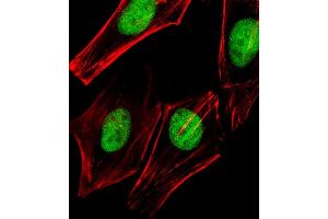 Immunofluorescent analysis of 4 % paraformaldehyde-fixed, 0. (TRRAP anticorps  (C-Term))
