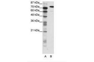 Image no. 1 for anti-SATB Homeobox 1 (SATB1) (C-Term) antibody (ABIN202904) (SATB1 anticorps  (C-Term))