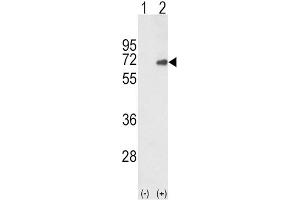 Western Blotting (WB) image for anti-SMAD Family Member 4 (SMAD4) antibody (ABIN3003471) (SMAD4 anticorps)