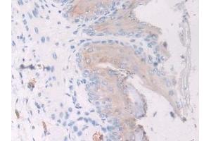 Detection of CDK1 in Mouse Esophagus Tissue using Polyclonal Antibody to Cyclin Dependent Kinase 1 (CDK1)