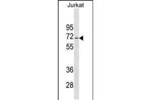 Western blot analysis in Jurkat cell line lysates (35ug/lane). (JRKL anticorps  (C-Term))