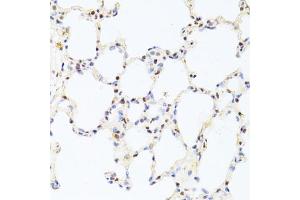 Immunohistochemistry of paraffin-embedded rat lung using CREB1 antibody (ABIN6290133) at dilution of 1:100 (40x lens).