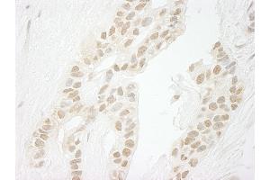 anti-Protein Phosphatase 1, Catalytic Subunit, gamma Isoform (PPP1CC) (C-Term) antibody