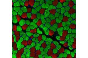 Immunofluorescent analysis of paraformaldehyde-fixed mouse skeletal muscle using MYH1 (, red) and MYH7 (ABIN7075623, green) at dilution of 1: 100 (Slow Skeletal Myosin Heavy Chain anticorps)