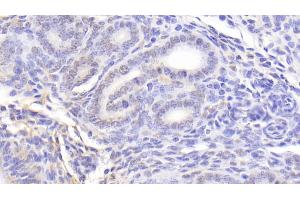 Detection of NCL in Mouse Uterus Tissue using Polyclonal Antibody to Nucleolin (NCL)