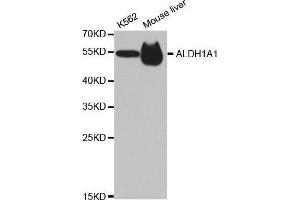 Western blot analysis of extracts of various cell lines, using ALDH1A1 antibody. (ALDH1A1 anticorps  (AA 48-147))