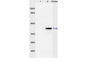 Lane 1: mouse brain lysates Lane 2: mouse thyroid lysates probed with Anti TTF-2/FOXE1 Polyclonal Antibody, Unconjugated (ABIN668721) at 1:200 in 4 °C.