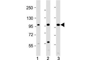 Csf1r antibody western blot analysis in 1) mouse skeletal muscle, 2) rat skeletal muscle and 3) mouse heart tissue lysate. (CSF1R anticorps  (AA 895-923))