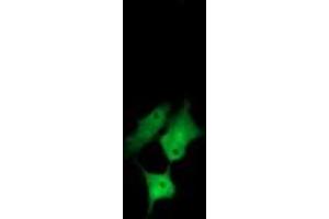 Image no. 2 for anti-Chaperonin Containing TCP1, Subunit 8 (Theta)-Like 2 (CCT8L2) antibody (ABIN1497480) (CCT8L2 anticorps)